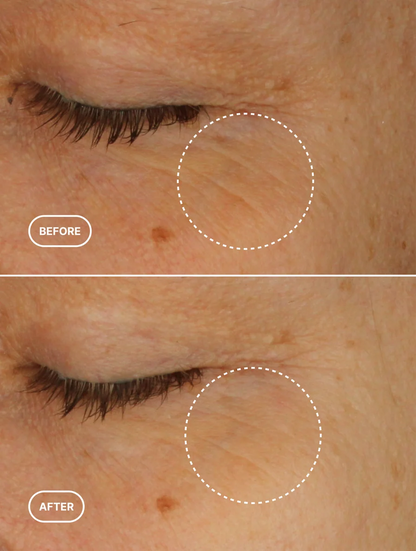 Retinol Alternative Eye Serum